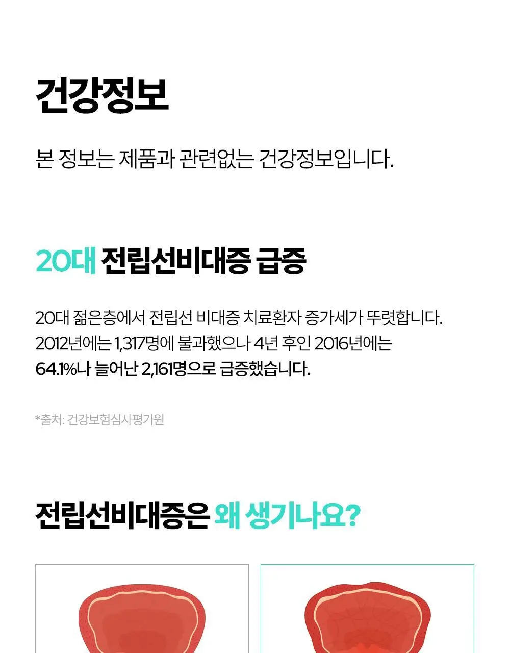 익스트림 쏘팔메토 옥타코사놀 550mgX30캡슐(30일분) 상세페이지 78