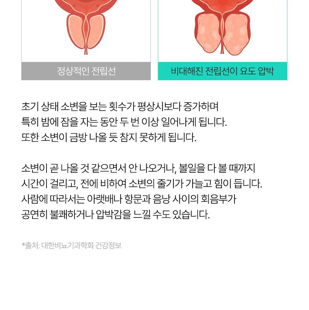 익스트림 쏘팔메토 옥타코사놀 550mgX30캡슐(30일분) 상세페이지 80
