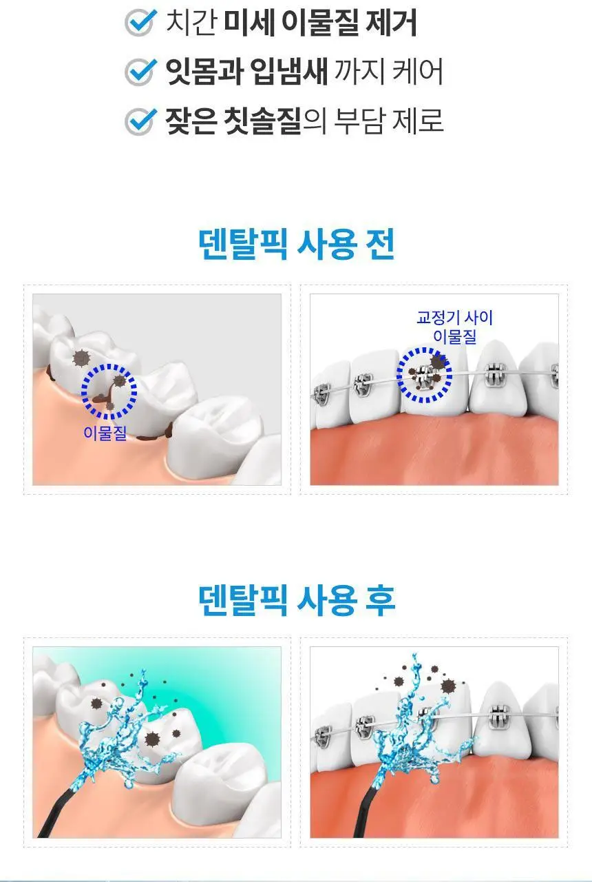 덴탈픽 휴대용 구강세정기 DP-2300K 상세페이지 3