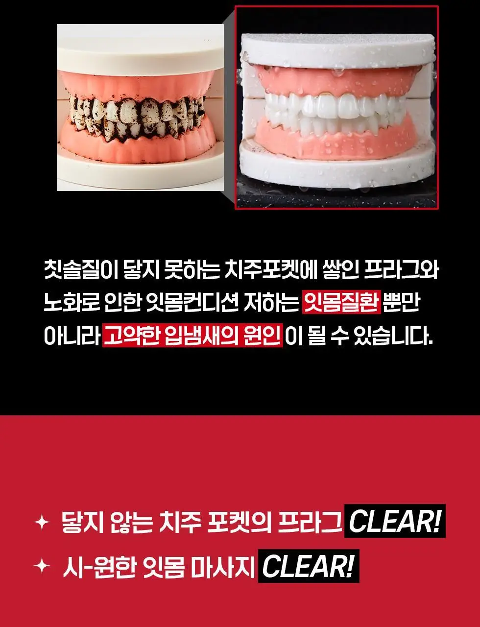 덴트릭스 소닉펄스 마사지샷 구강세정기 상세페이지 13