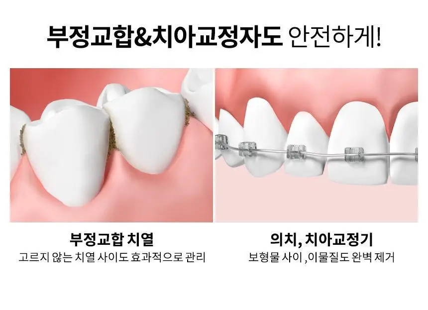 오아 클린이워터B 휴대용 무선 구강세정기 상세페이지 33