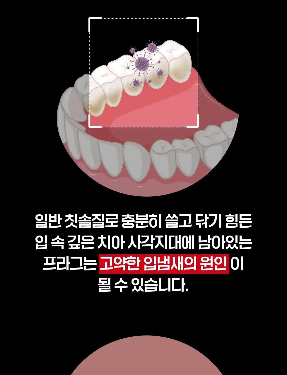 덴트릭스 소닉스핀 전동칫솔 상세페이지 10