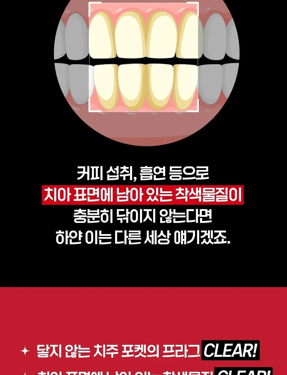 덴트릭스 소닉스핀 전동칫솔 상세페이지 11