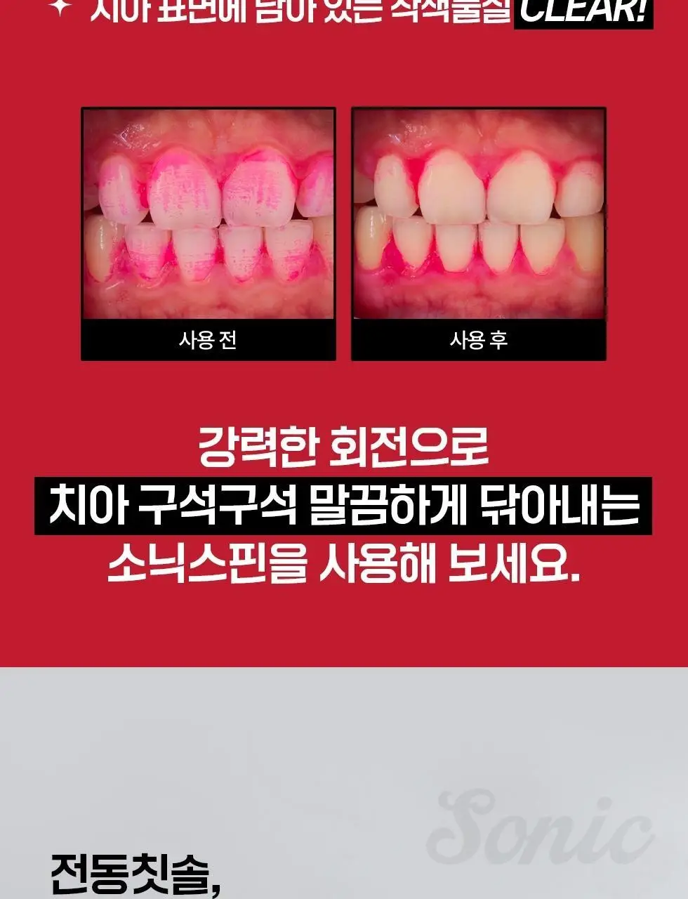 덴트릭스 소닉스핀 전동칫솔 상세페이지 12