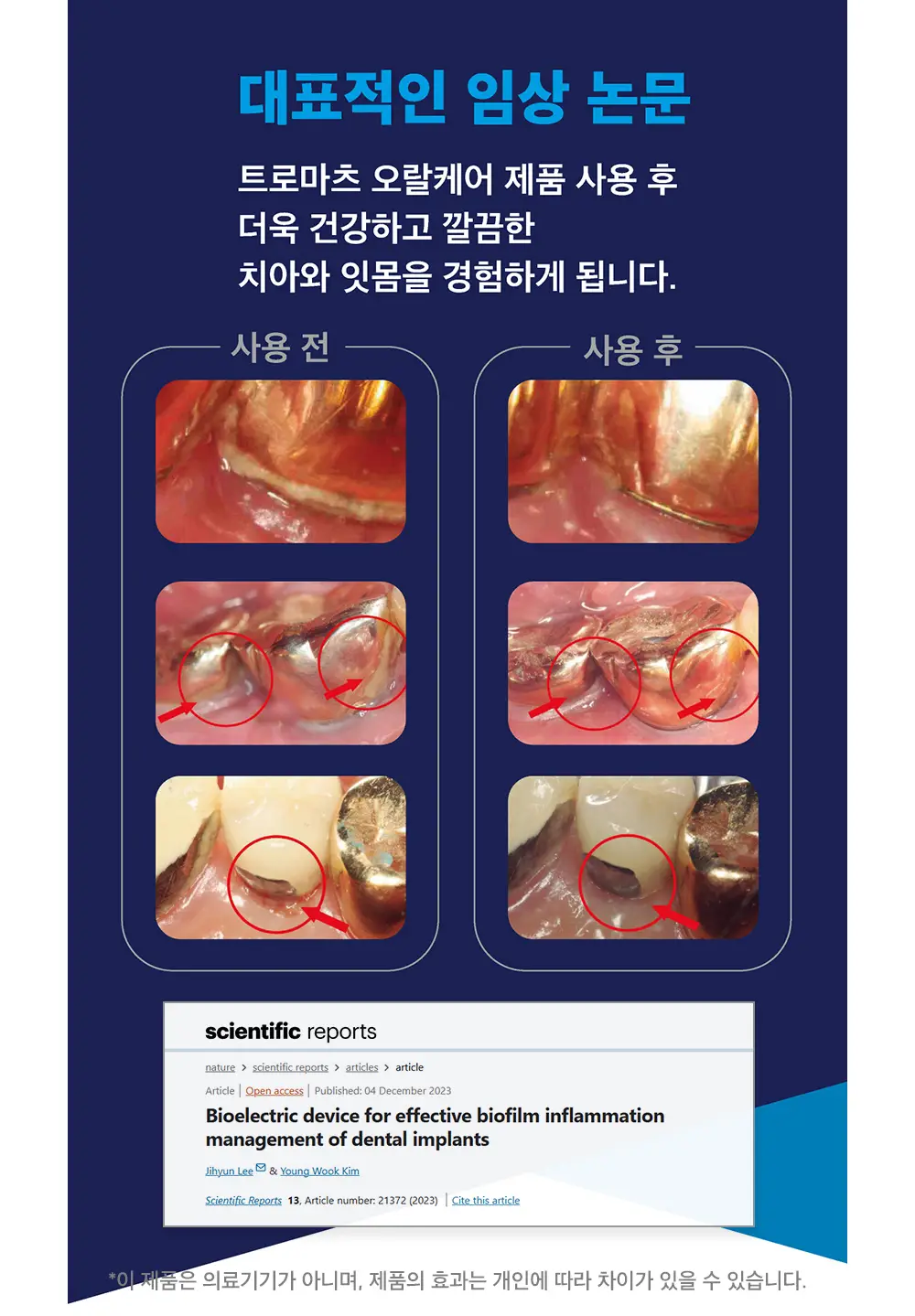 트로마츠 심플 프로 생체전류 칫솔 (충전형) 상세페이지 7