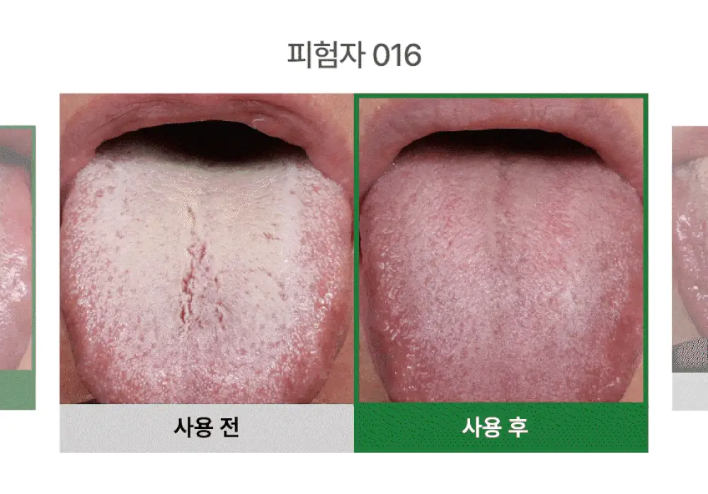 노도르 백태&구취 제거 2종 기획(고체가글 30정+혀클리너) 상세페이지 16
