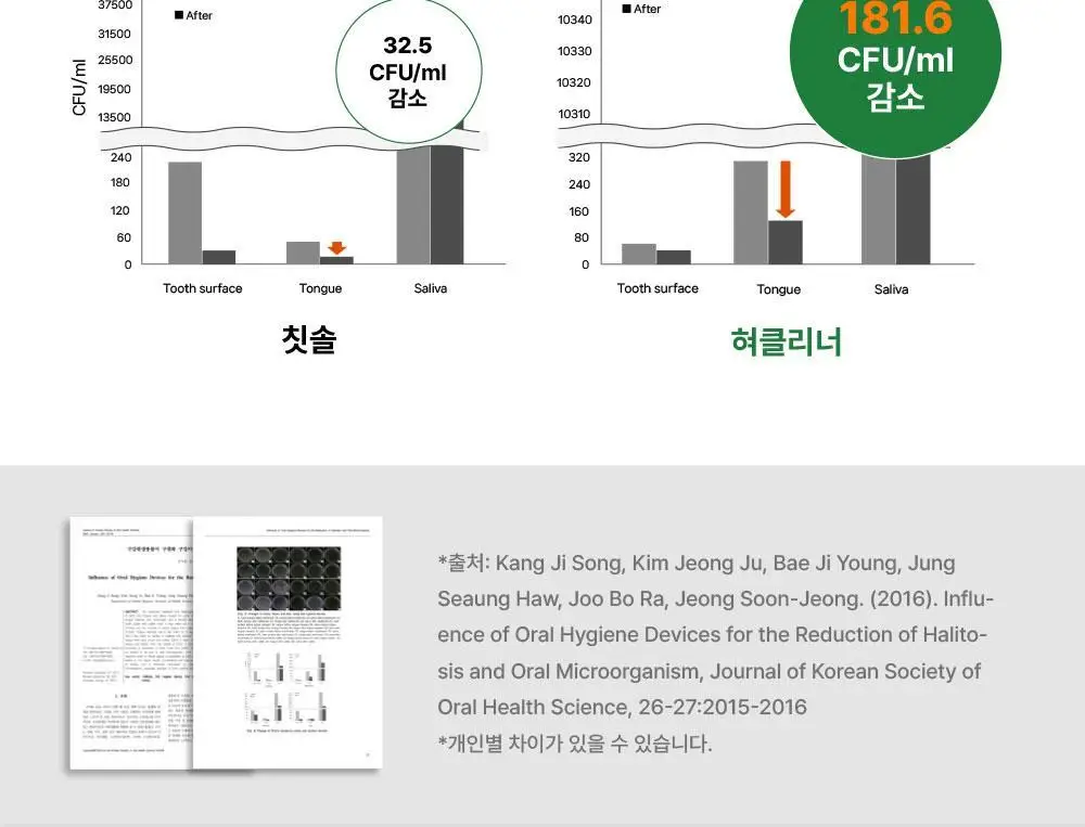 노도르 백태&구취 제거 2종 기획(고체가글 30정+혀클리너) 상세페이지 41