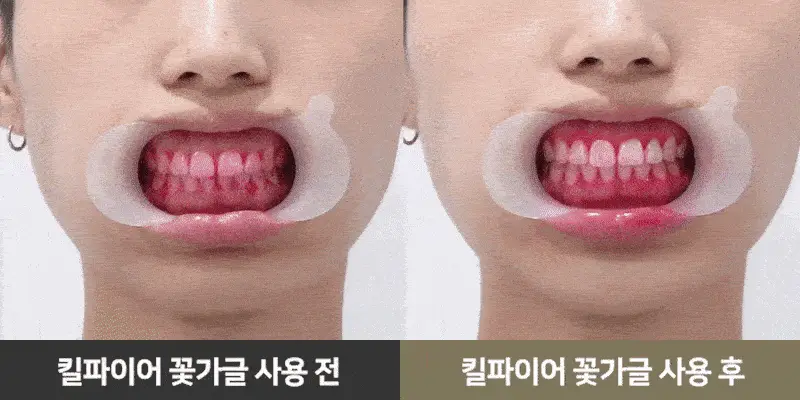 빠이러스 킬파이어 쿨가글액(플라워향) 500ml 상세페이지 40