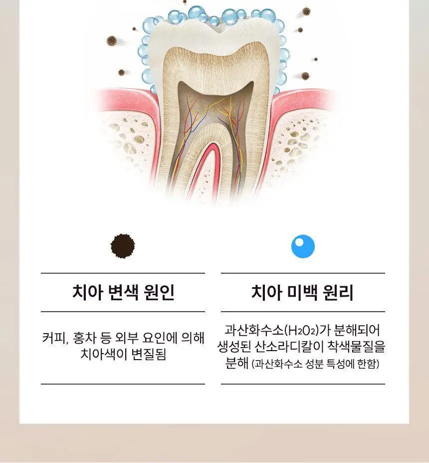 뷰센 치아미백제 80g 2입 세트 (뷰센15, 28) 상세페이지 20