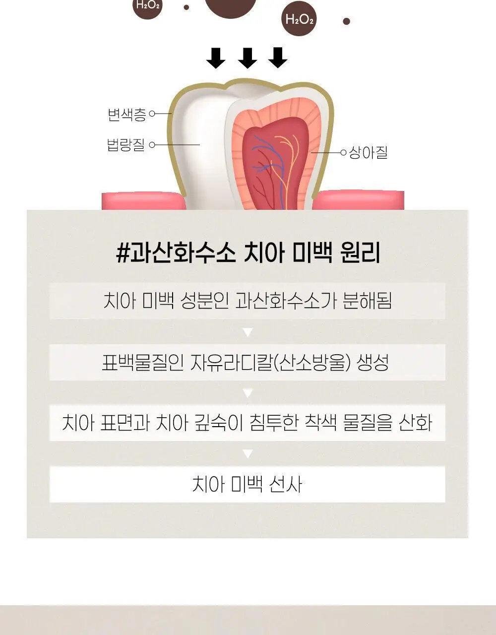 뷰센 화이트 치아 미백패치 일주일팩 7매 (+뷰센28 미니 20g 증정) 상세페이지 6