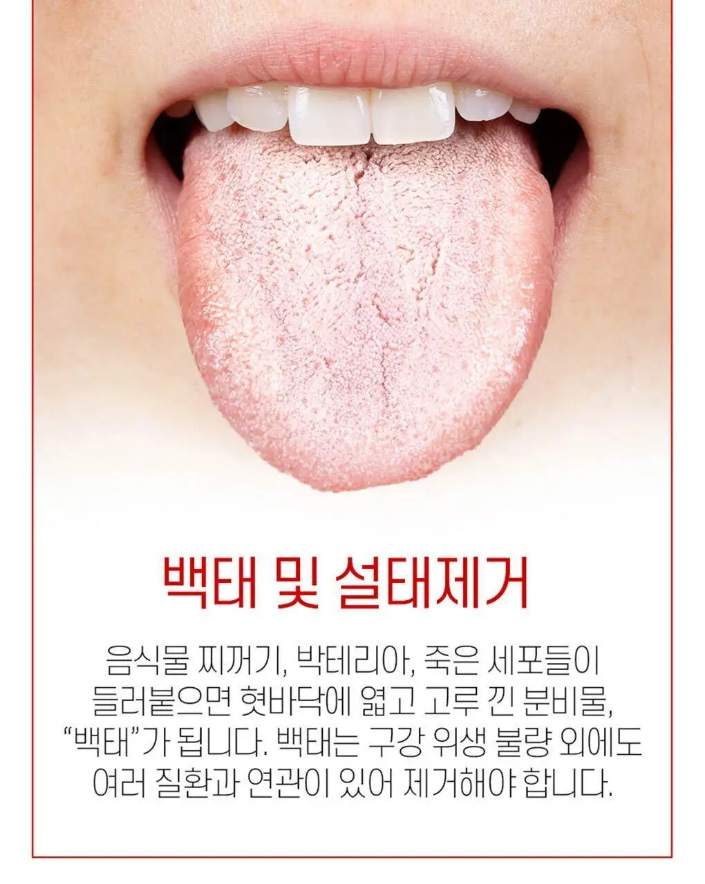 KENT 혀클리너 (블루) 상세페이지 7
