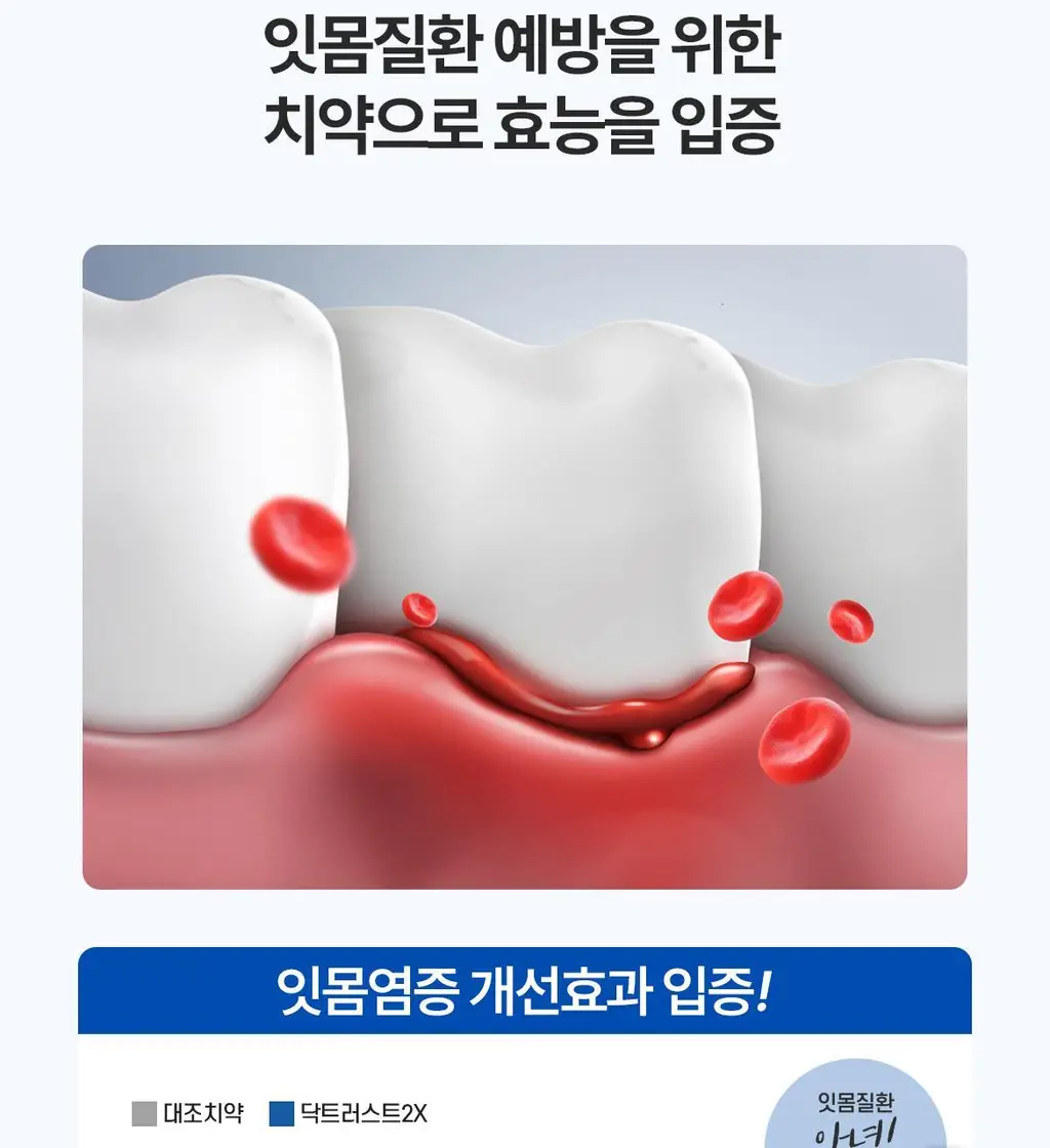 닥스메디 닥트러스트 치약 3종 택1 (1S/2X/프로엔프리) 상세페이지 48