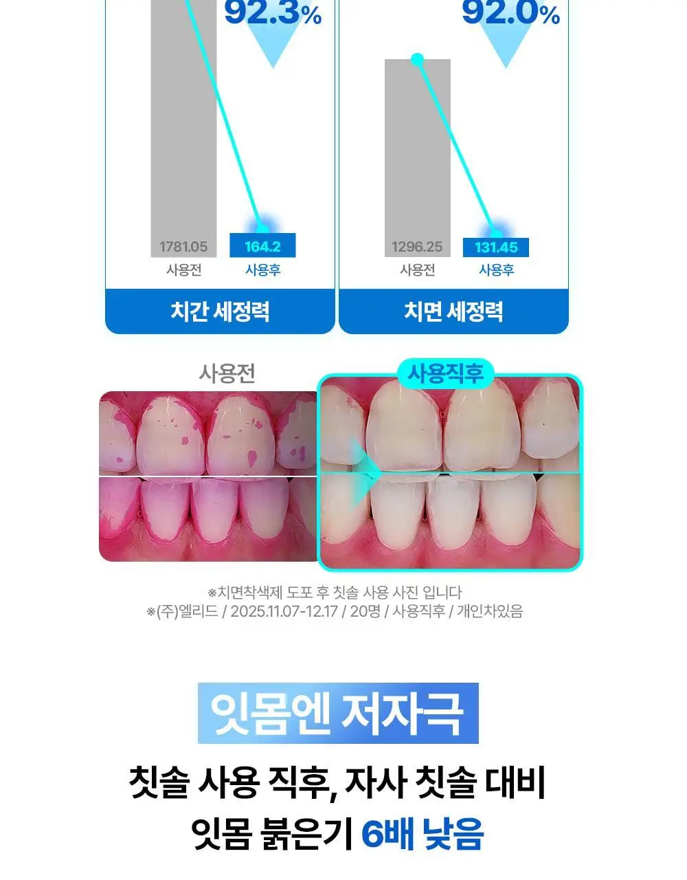 덴티스테 플러스화이트 프로 치약 100g 기획 (+어드밴스드케어 칫솔) (2606) 상세페이지 10