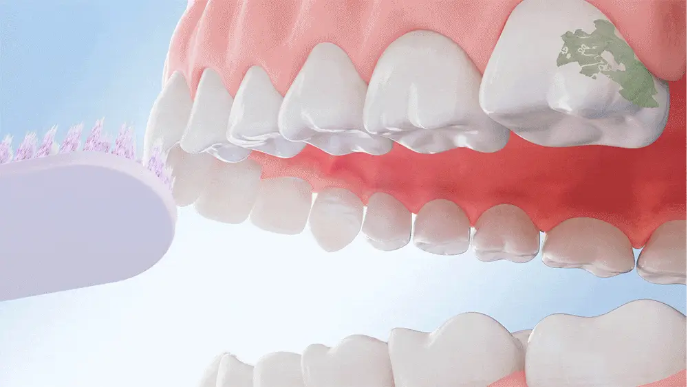 덴티스테 플러스화이트 프로 치약 100g 기획 (+어드밴스드케어 칫솔) (2606) 상세페이지 16