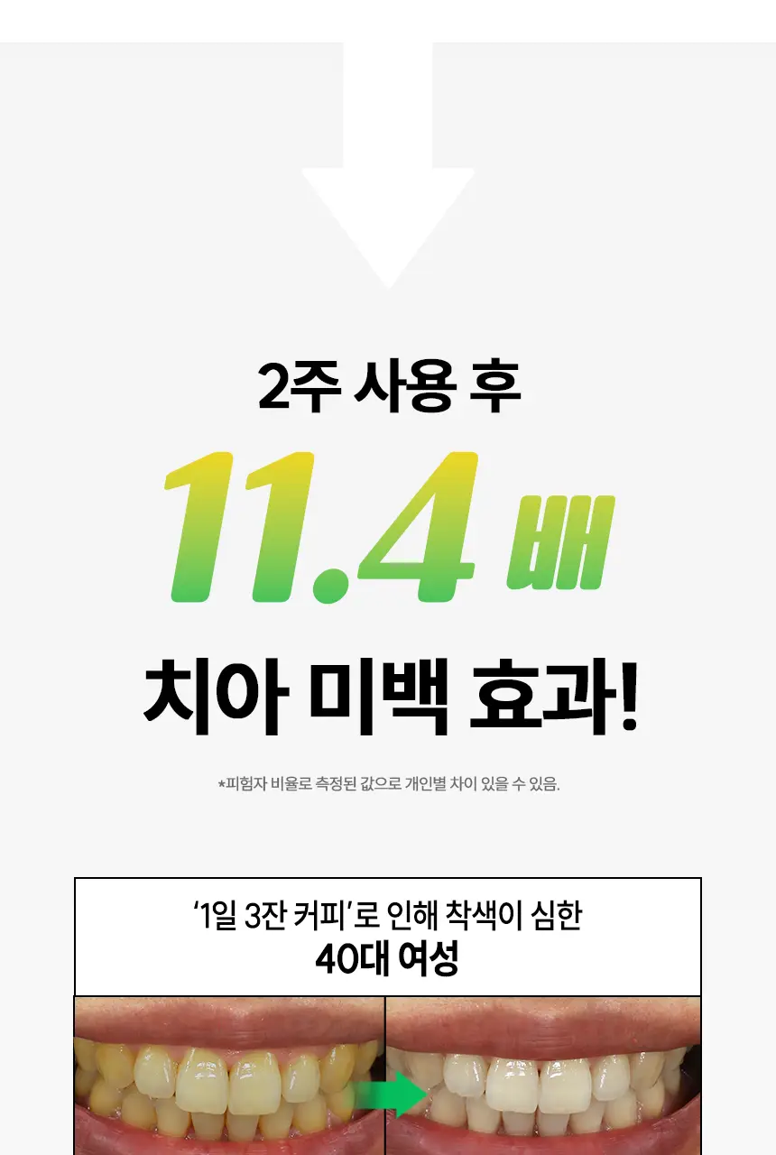 브리올 미백보장 프리미엄 미백치약 120g 상세페이지 4