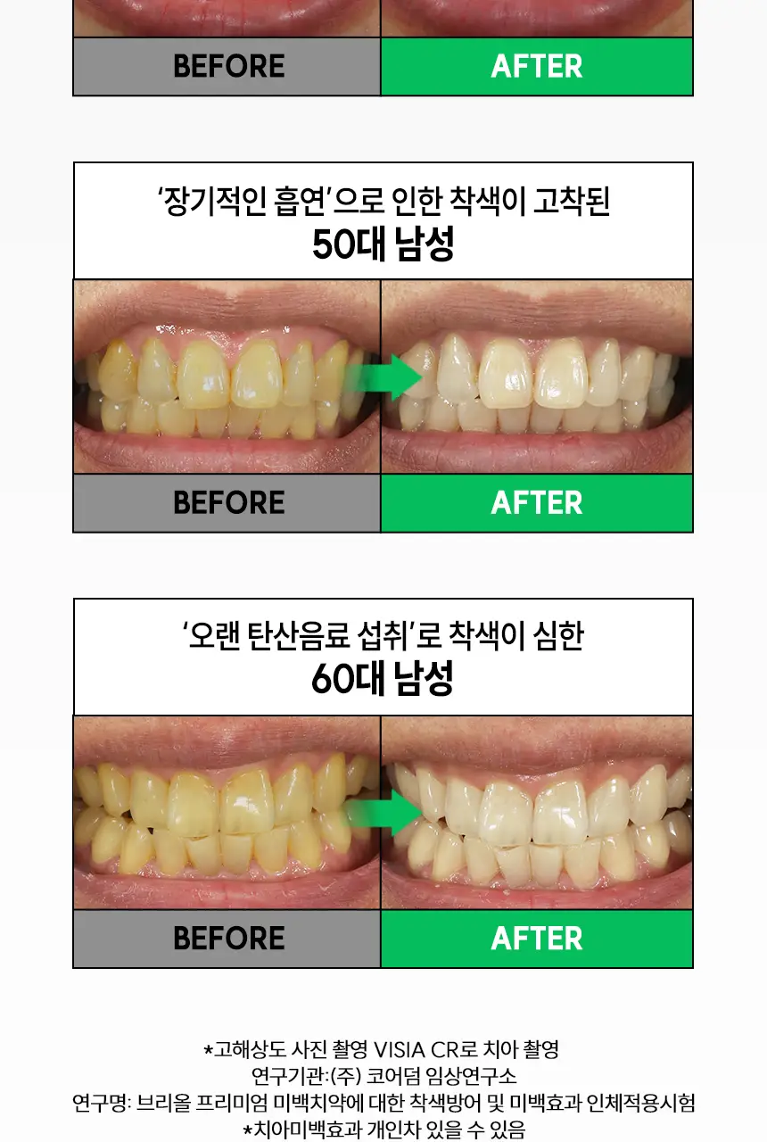 브리올 미백보장 프리미엄 미백치약 120g 상세페이지 5