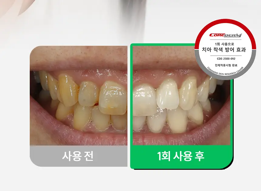 브리올 미백보장 프리미엄 미백치약 120g 상세페이지 20