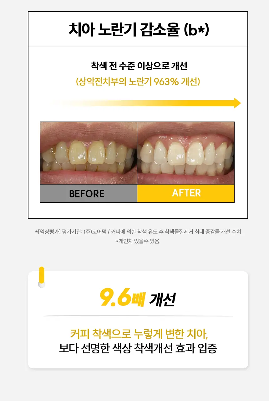 브리올 미백보장 프리미엄 미백치약 120g 상세페이지 23