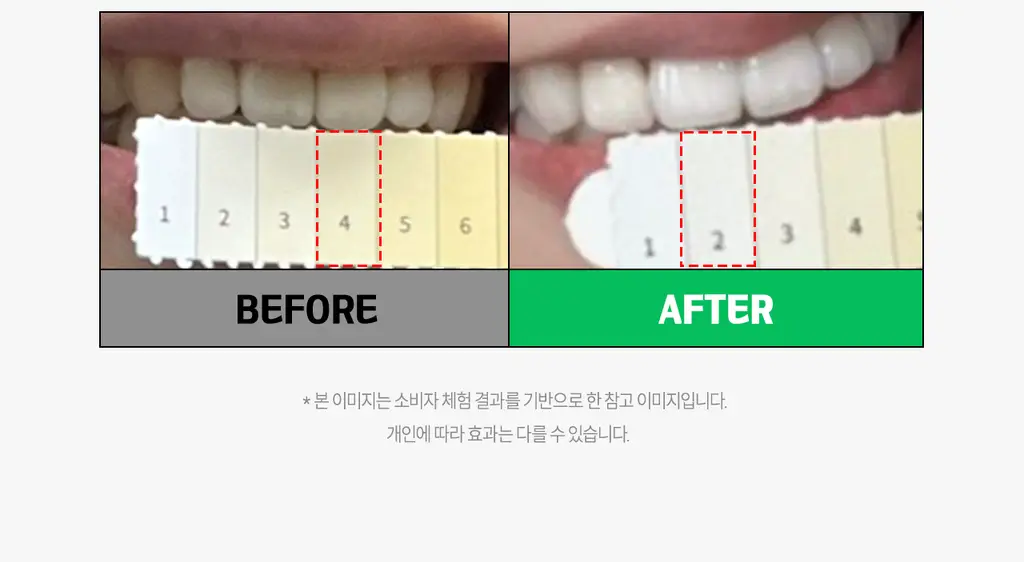 브리올 미백보장 프리미엄 미백치약 120g 상세페이지 59