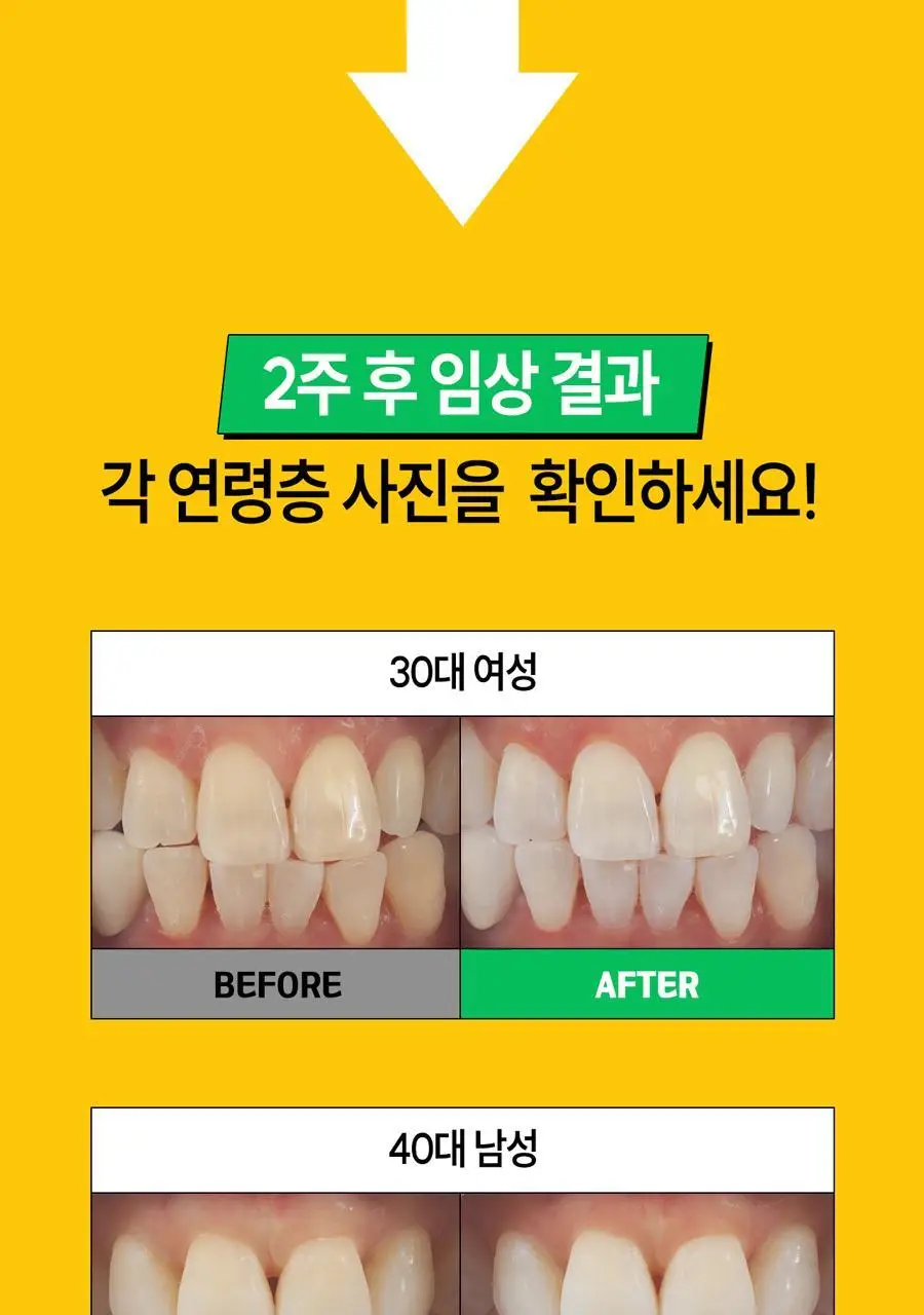 브리올 미백보장 프리미엄 치약&칫솔 세트 상세페이지 6