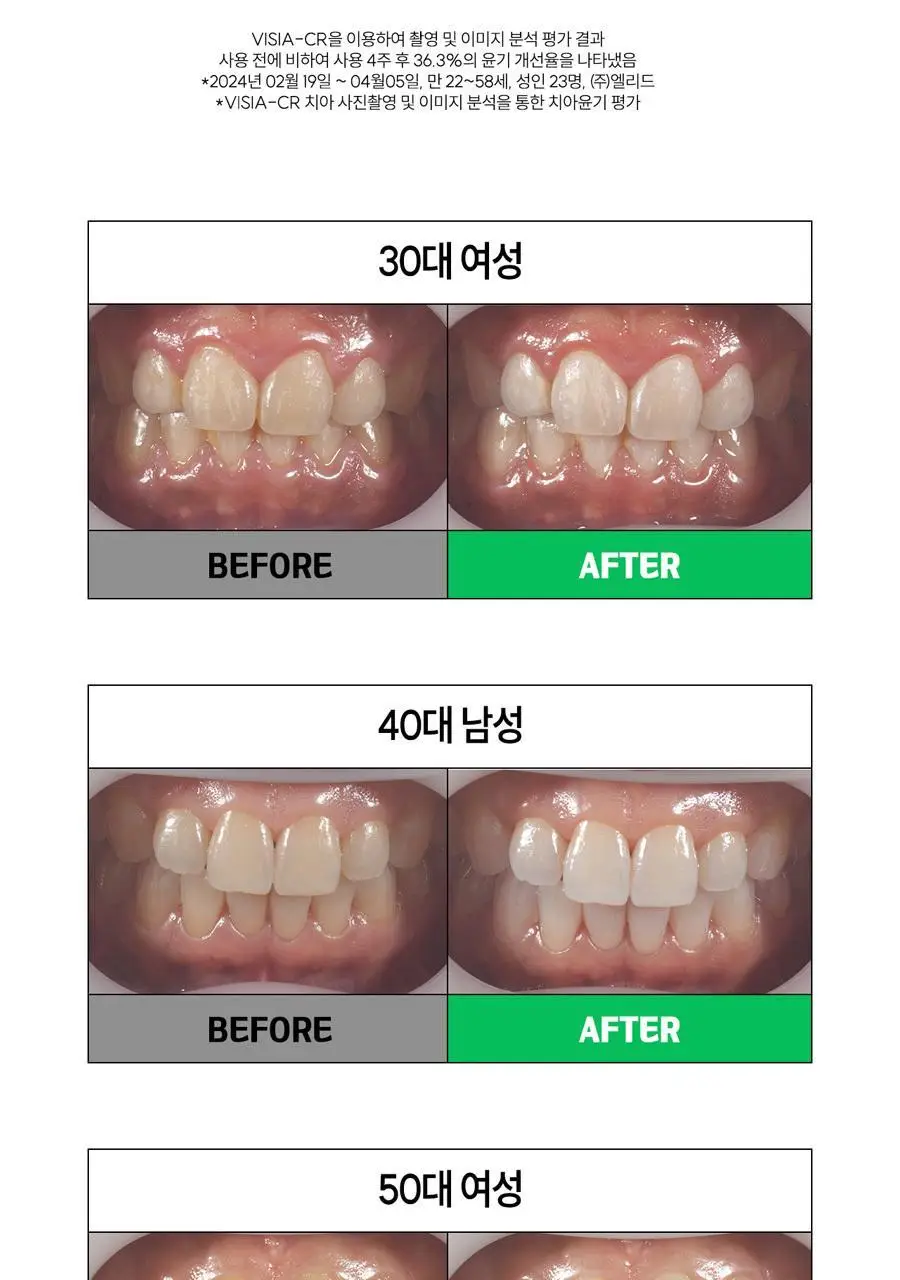 브리올 미백보장 프리미엄 치약&칫솔 세트 상세페이지 27