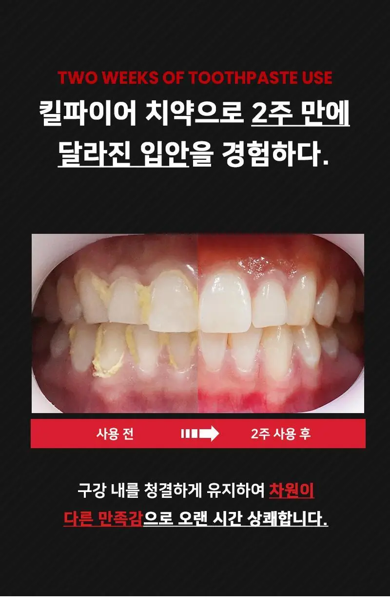 빠이러스 킬파이어 치약 상세페이지 5