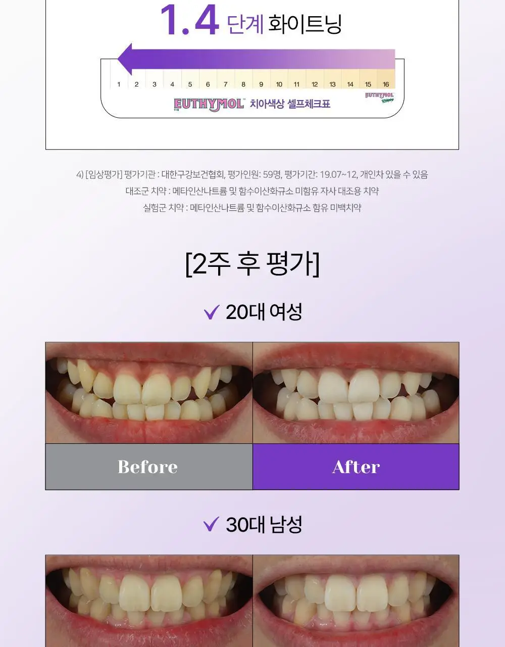 유시몰 퍼플코렉터 치약 106g 기획 (+퍼플 글로우 파우치) (바비 콜라보) 상세페이지 29