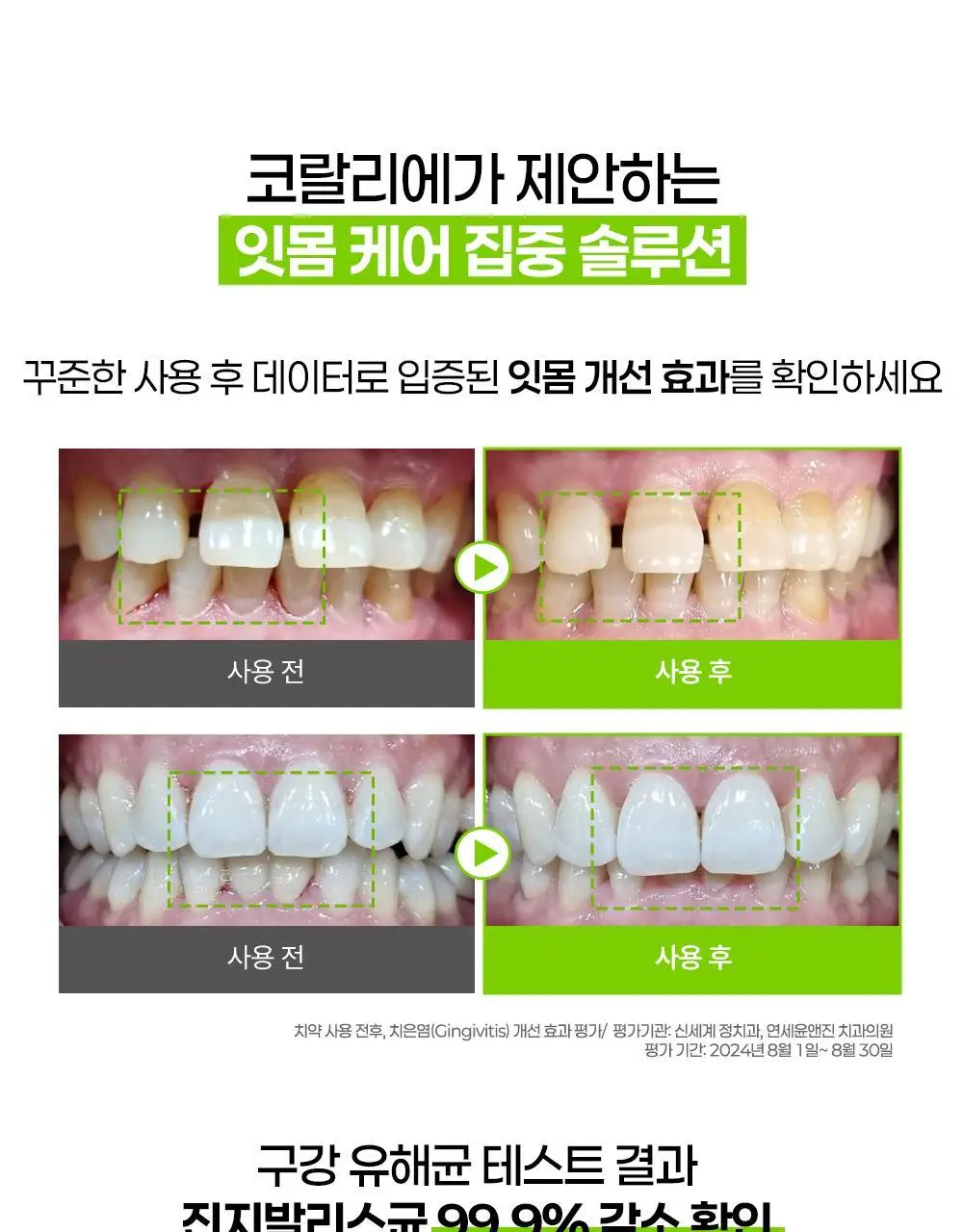 코랄리에 치약 2종 택1 (바질레몬 잇몸치약/애플민트 미백치약) 상세페이지 13