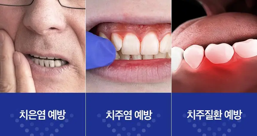 화이니카 치탄플러스 분말치약 20g 상세페이지 6