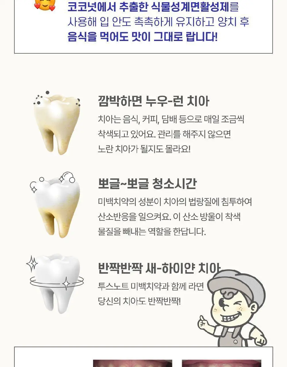 투스노트 미백치약 아쿠아민트 100g 상세페이지 4
