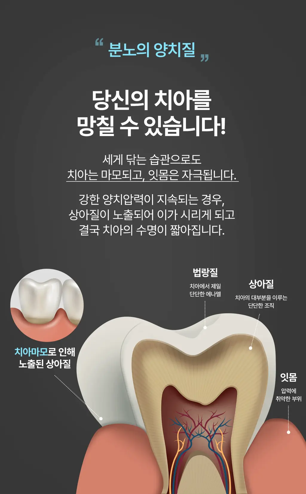 덴클 올인원 플러스케어 칫솔 1개입 상세페이지 7
