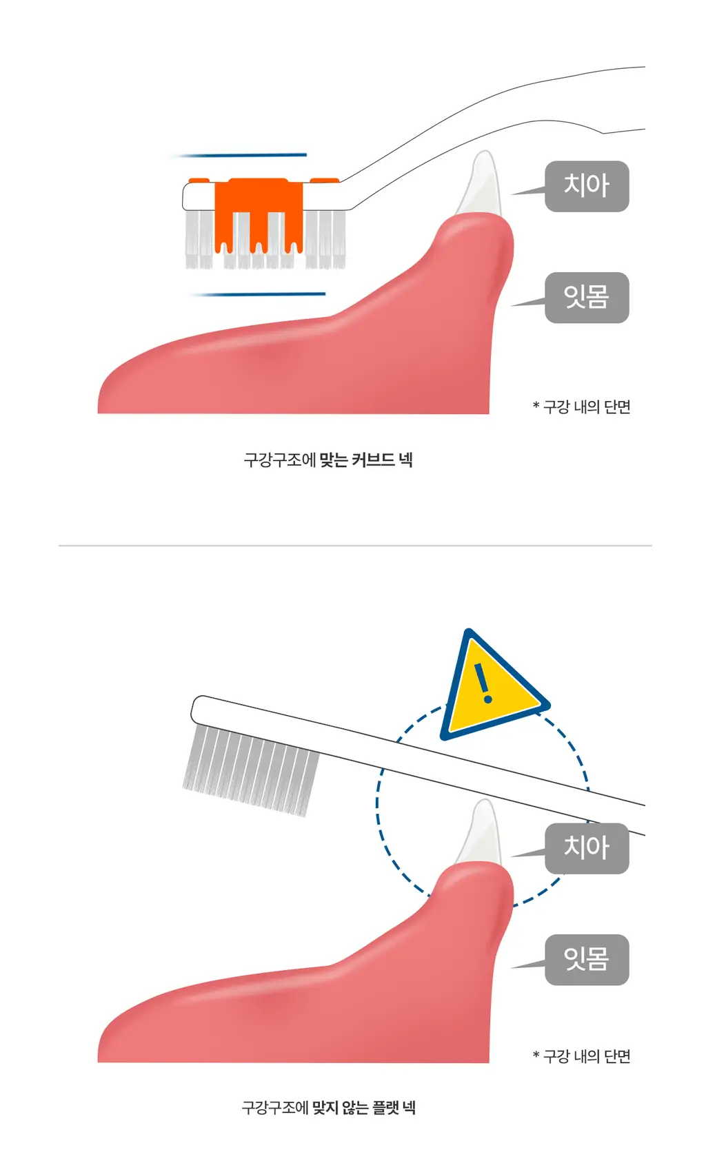 덴클 올인원 플러스케어 칫솔 1개입 상세페이지 18