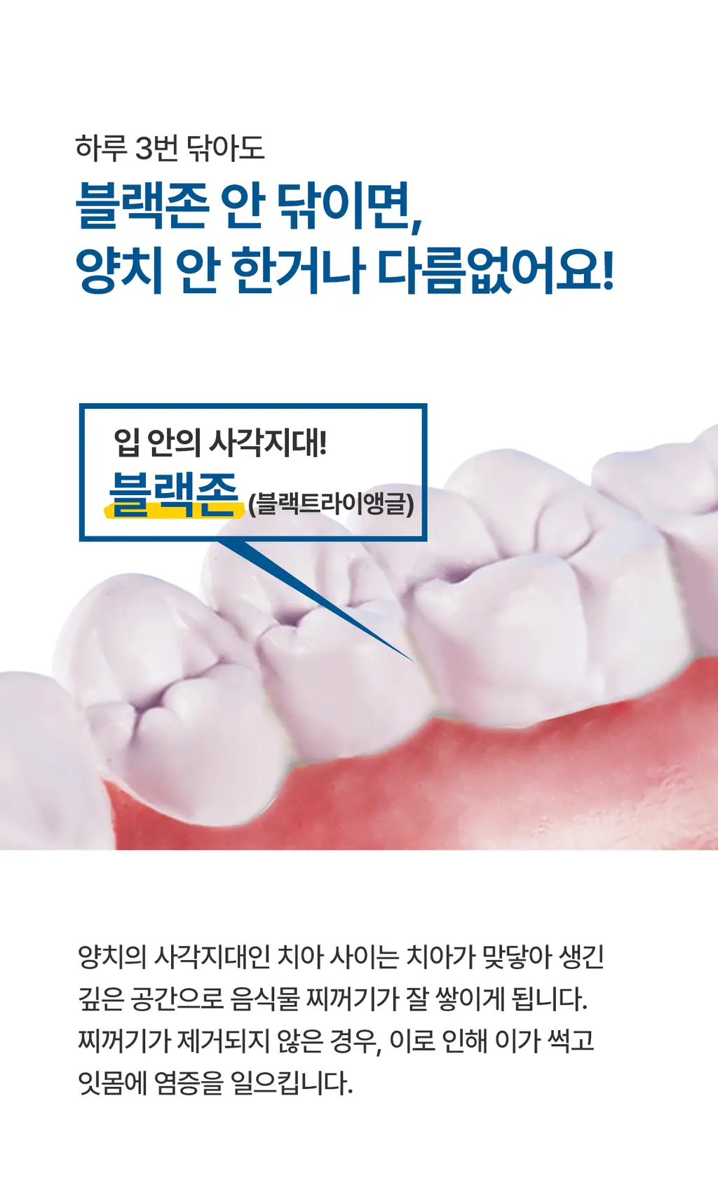 덴클 올인원케어 칫솔 1개입 상세페이지 10