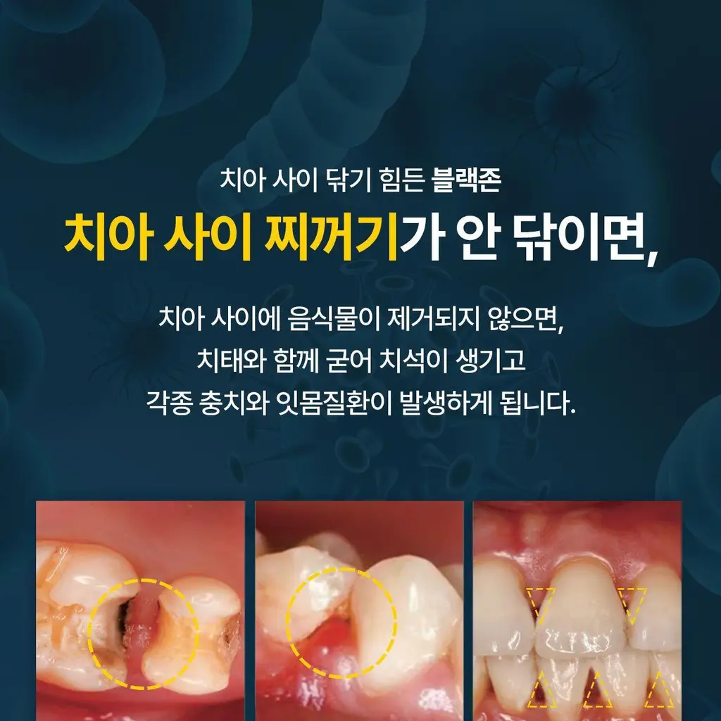 덴클 올인원케어 칫솔 1개입 상세페이지 11
