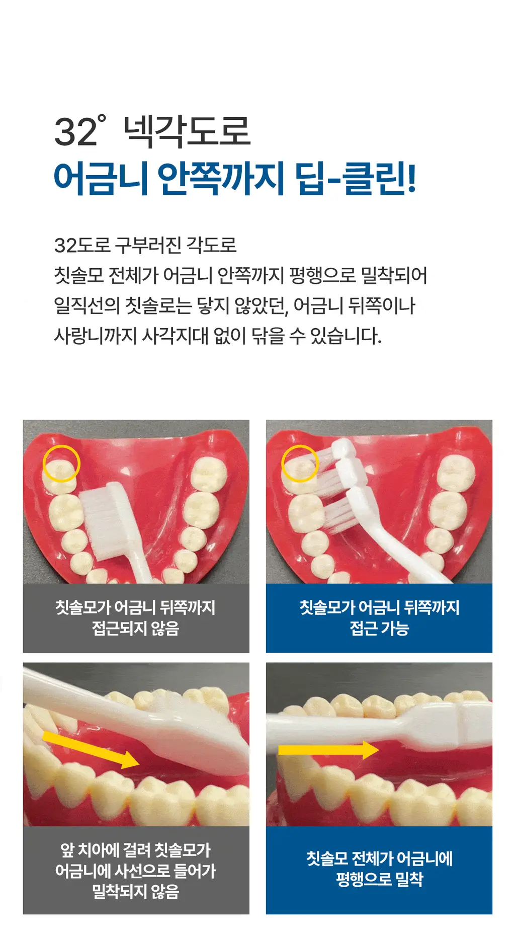 덴클 올인원케어 칫솔 1개입 상세페이지 36