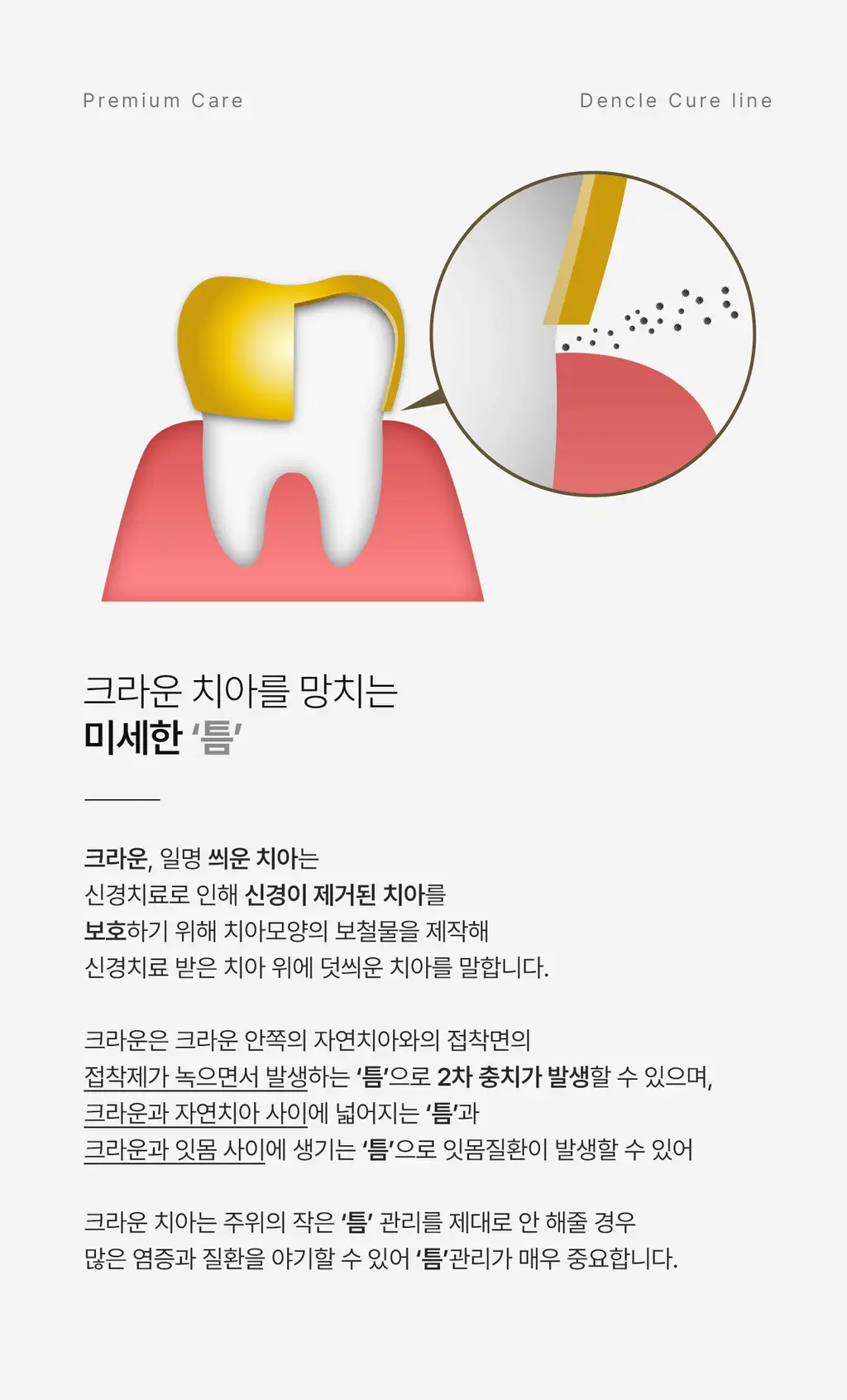 덴클 크라운케어 칫솔 1개입 상세페이지 7