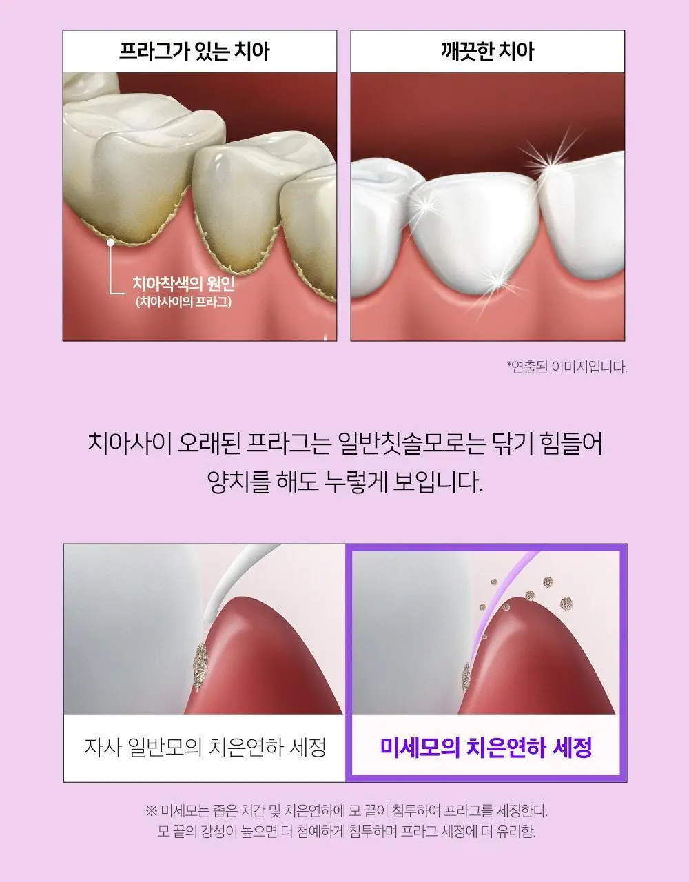유시몰 퍼플 화이트닝 칫솔 2입 기획 상세페이지 8