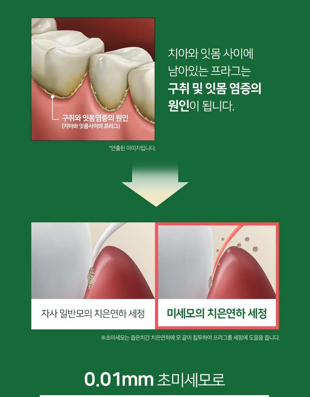 유시몰 클래식 칫솔 1입 상세페이지 8