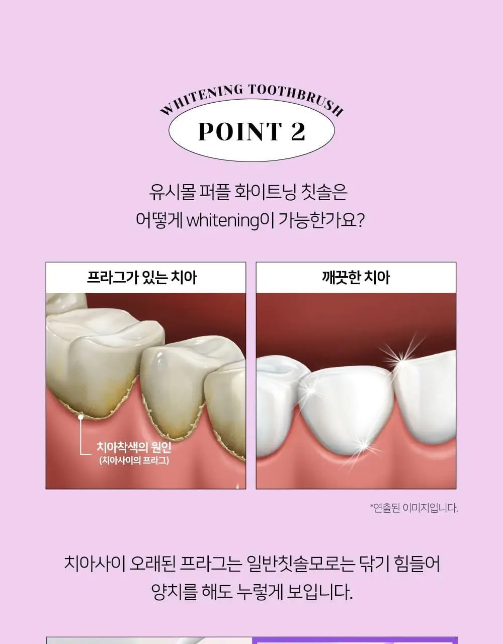 유시몰 퍼플화이트닝 칫솔 3입 기획 (+퍼플 리유저블 컵) (바비 콜라보) 상세페이지 18