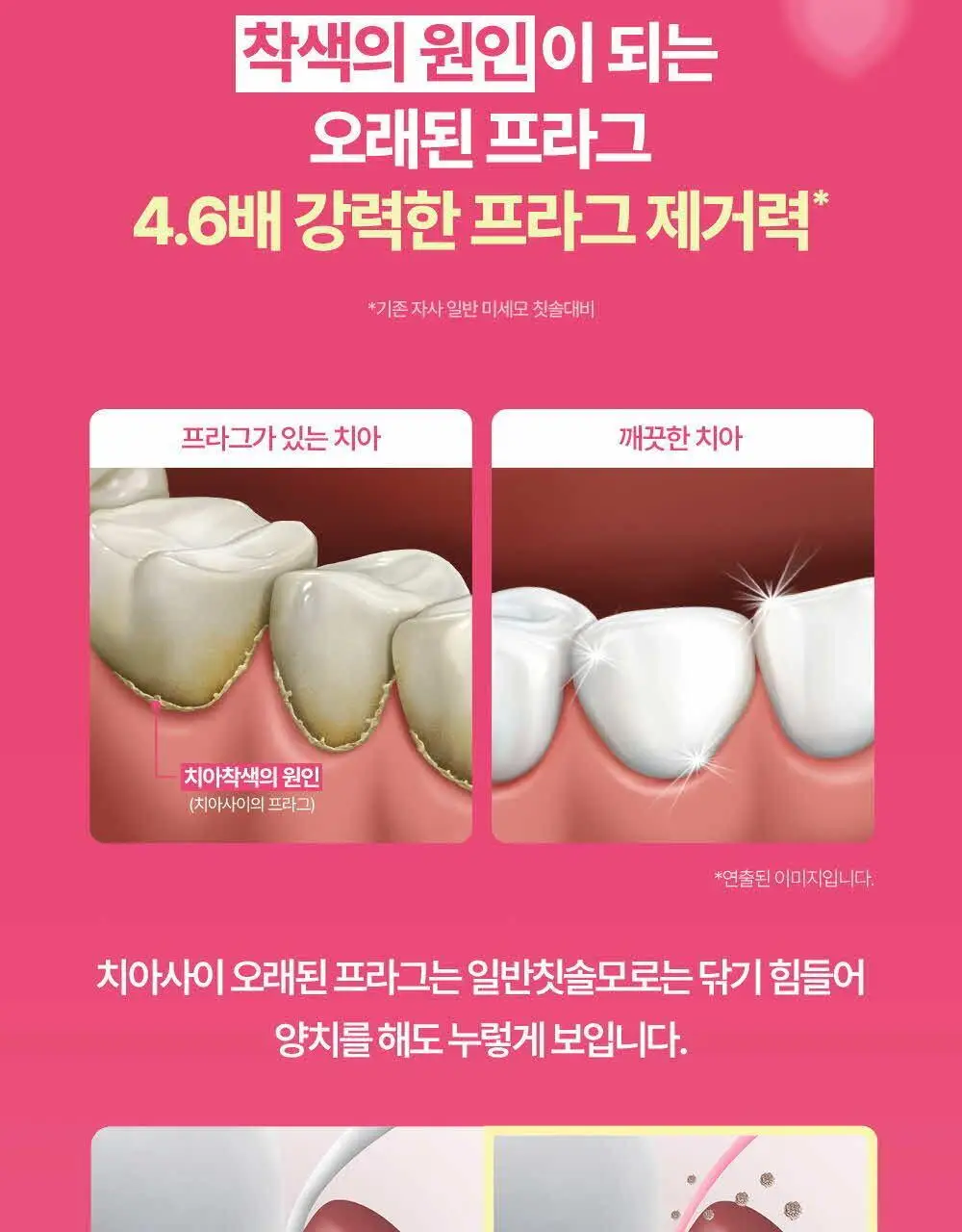 유시몰 화이트닝 미백 칫솔 2입 마이멜로디 기획 상세페이지 10