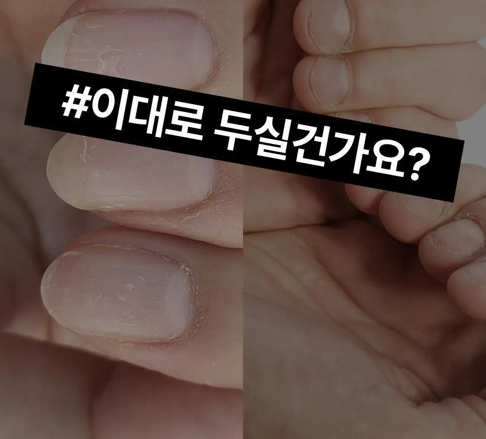 위드샨 네일스트랭쓰너 15ml 상세페이지 7