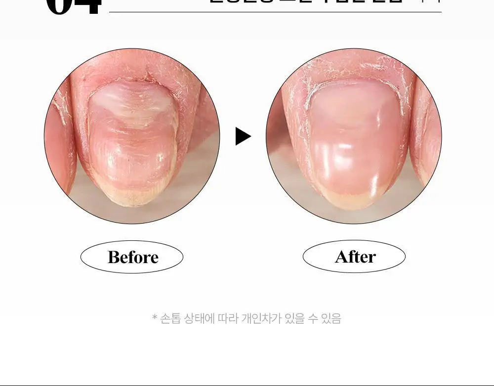 위드샨 케어라인 15ml 4종 상세페이지 23