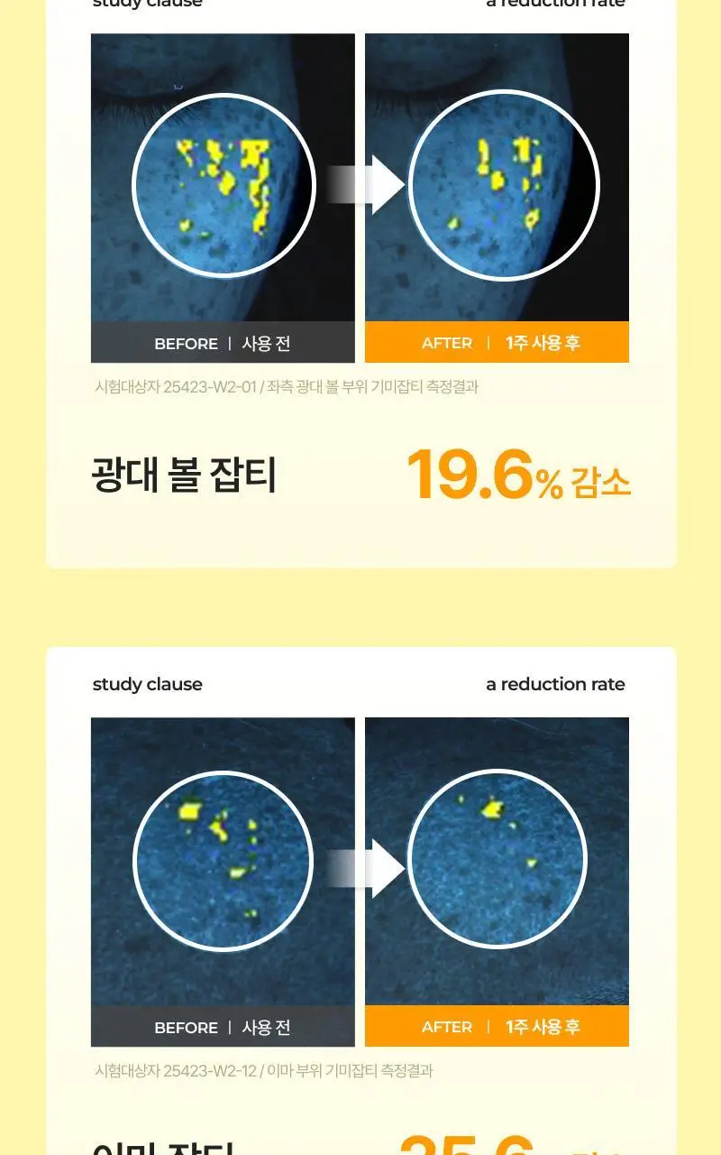 이지듀 멜라 비 토닝 앰플 글로우 겔 마스크 30g 4매 상세페이지 21