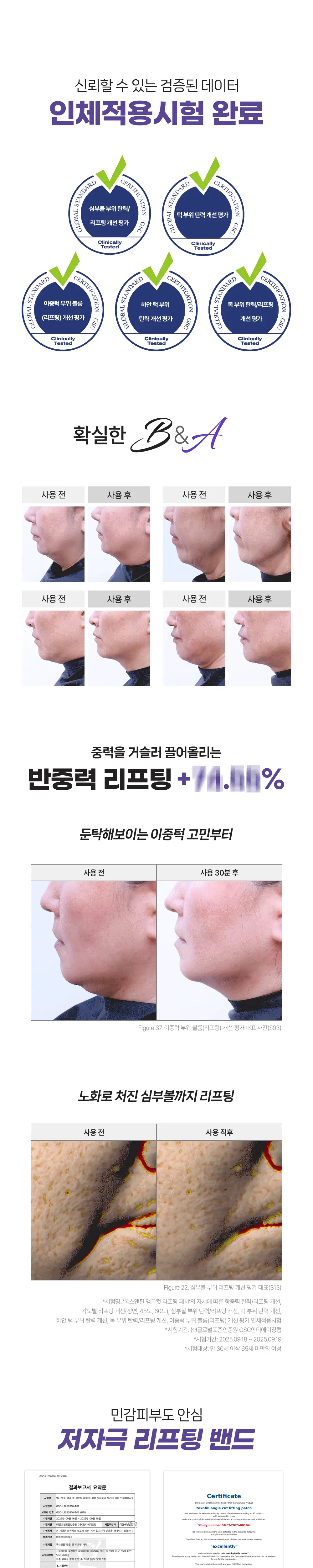 톡스앤필 앵글 컷 리프팅 패치 5매입 상세페이지 6