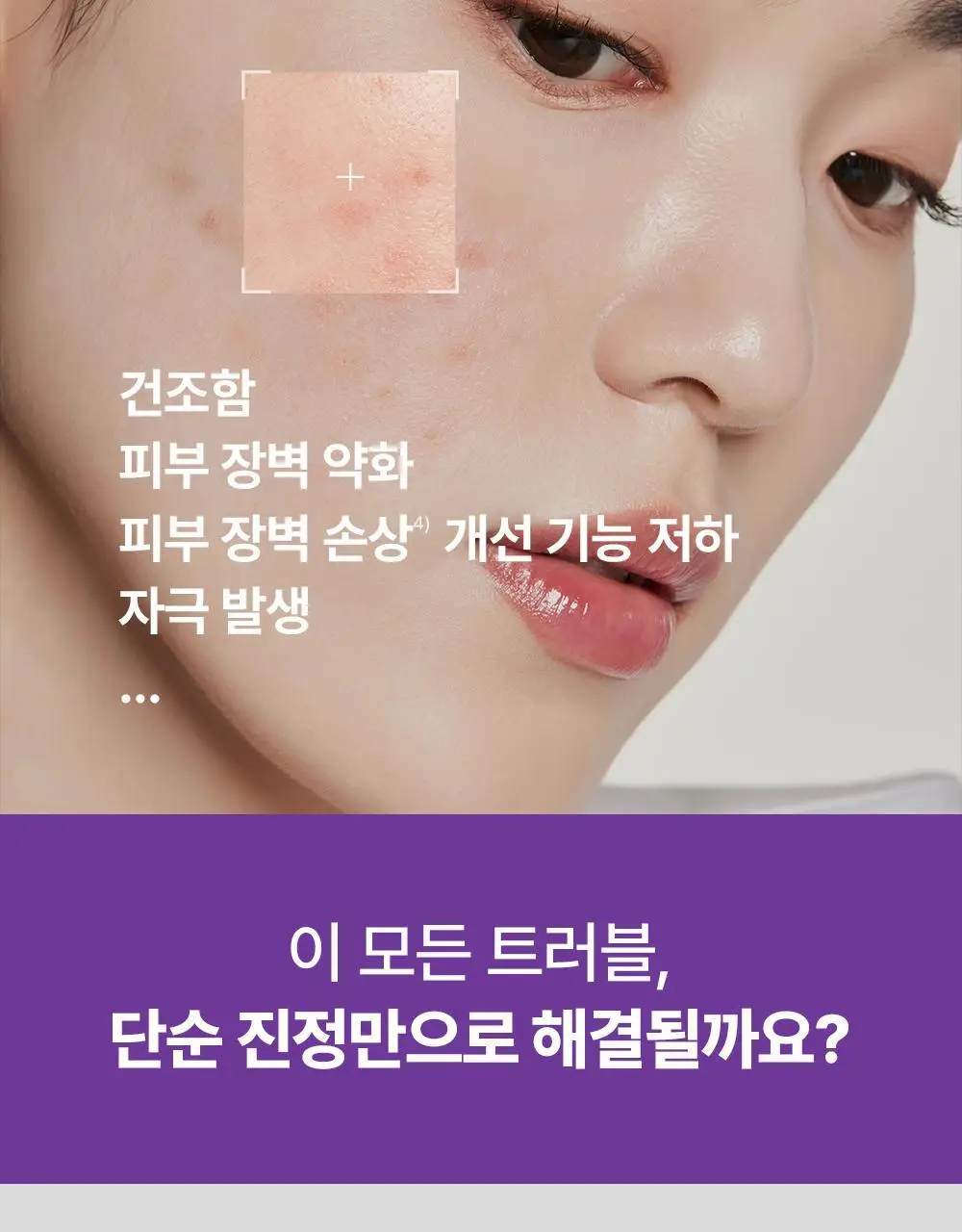 바이오더마 시카비오 크림+ 100ml(딥 리페어 크림) 상세페이지 8