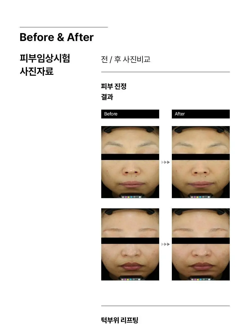 에르쯔틴 리제너레이티브 실트 크림 50g 상세페이지 18