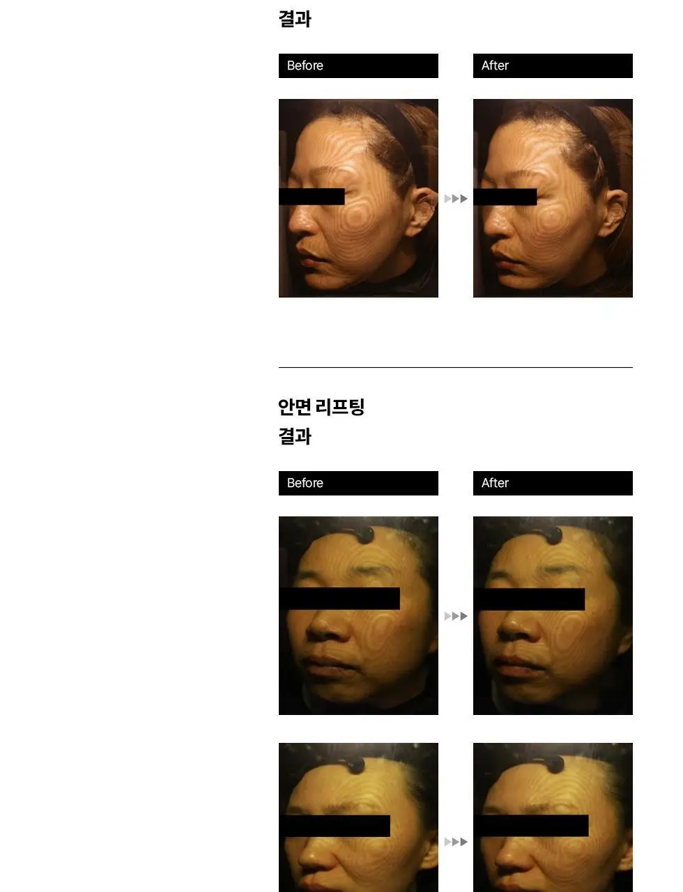 에르쯔틴 리제너레이티브 실트 크림 50g 상세페이지 19