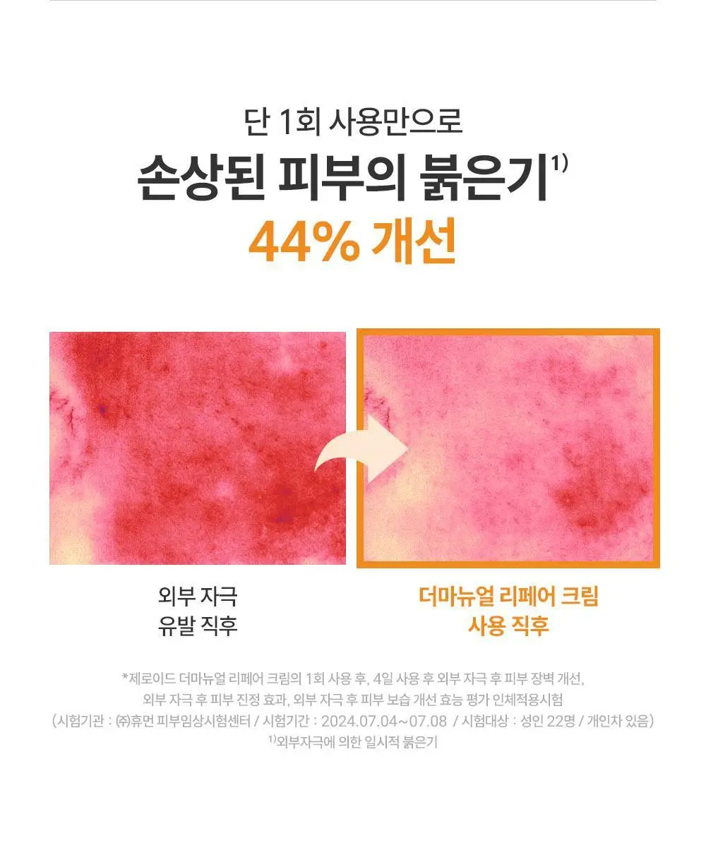 제로이드 더마뉴얼 리페어 크림 15ml 상세페이지 23