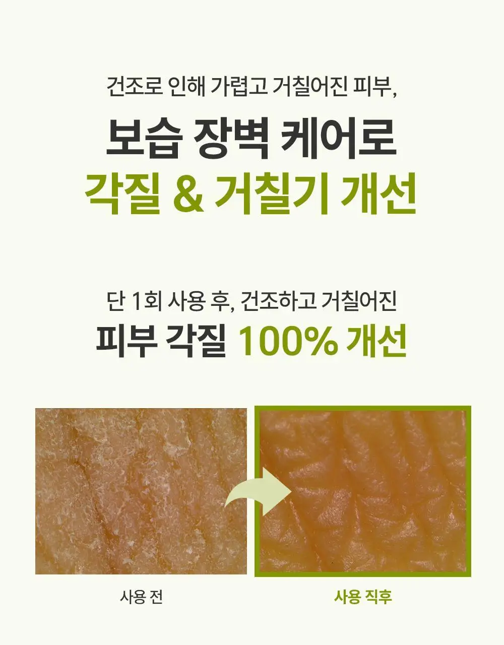 제로이드 인텐시브 로션 160ml 기획 (+크림 토너 25ml) 상세페이지 24