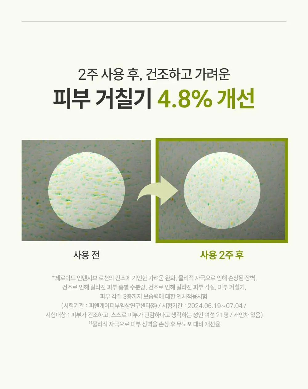 제로이드 인텐시브 로션 160ml 기획 (+크림 토너 25ml) 상세페이지 25